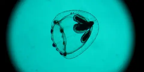Medusa Turritopsis nutricula, immortale, vista al microscopio. Struttura trasparente con organi scuri interni.